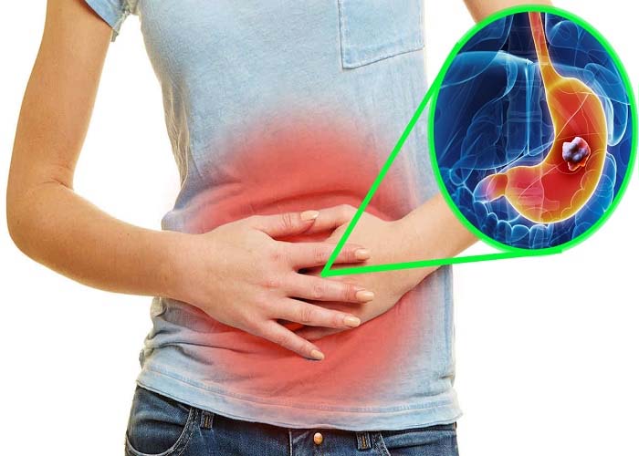 Warm Water Benefits : रोजाना सुबह खाली पेट गुनगुना पानी पीने से पाचन तंत्र से लेकर कई बीमारीयॉं होगी जड़ से खत्म
