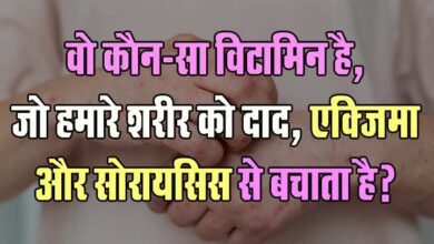 GK Questions : वो कौन-सा विटामिन है, जो हमारे शरीर को दाद, एक्जिमा और सोरायसिस से बचाता है?...