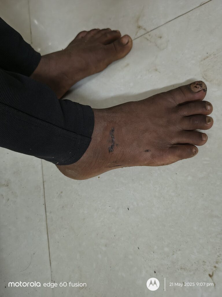 Damjipura Incident